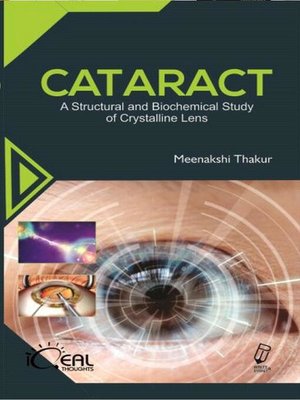 cover image of Cataract (A Structural and Biochemical Study of Crystalline Lens)